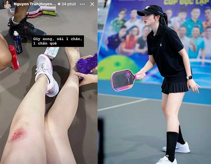 Á hậu Huyền My rướm máu vì chơi pickleball, hot girl Diệp Anh ẵm giải hoa khôi 1 Á Hậu Huyền My Bị Trầy Xước, Lật Cổ Chân Khi Chơi Pickleball